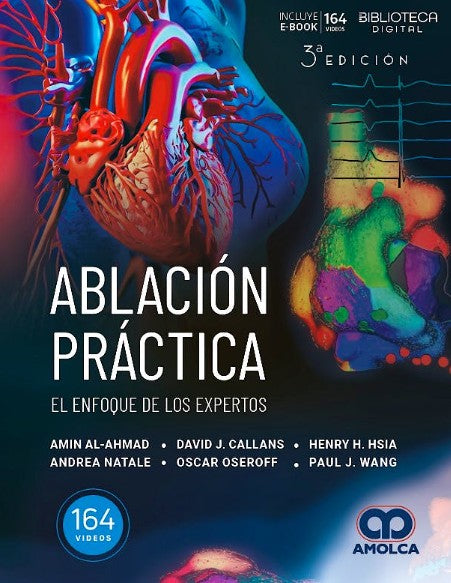 Ablación Práctica. El Enfoque de los Expertos