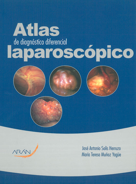 Atlas de diagnóstico diferencial laparoscópico