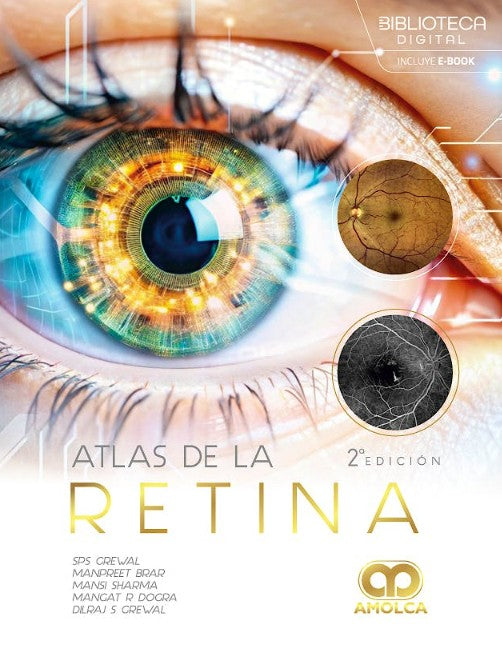 Atlas de la Retina