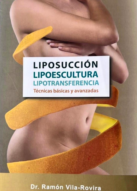 Liposucción, Lipoescultura, Lipotransferencia. Técnicas Básicas y Avanzadas