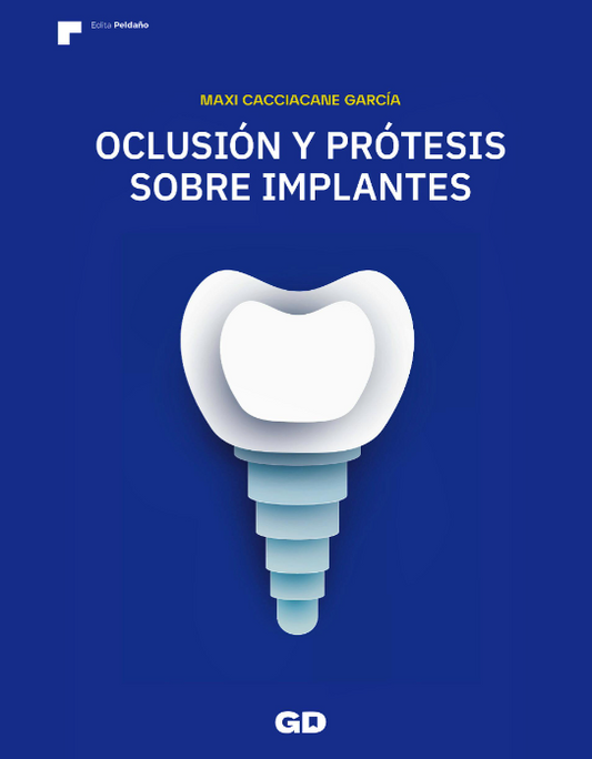 Oclusión y Prótesis sobre Implantes