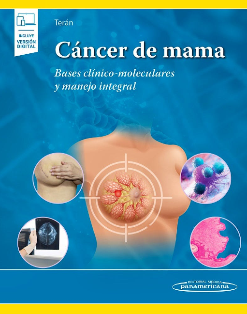 Cáncer de Mama. Bases Clínico-Moleculares y Manejo Integral
