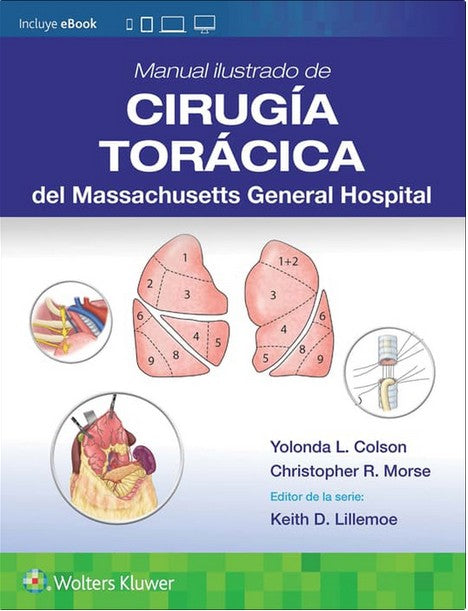 Manual ilustrado de Cirugía torácica del Massachusetts General Hospital