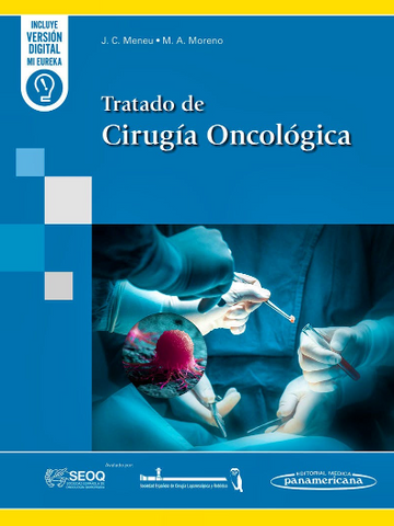 Tratado de Cirugía Oncológica Tratado de Cirugía Oncológica