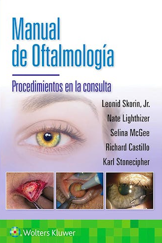 Manual de Oftalmología