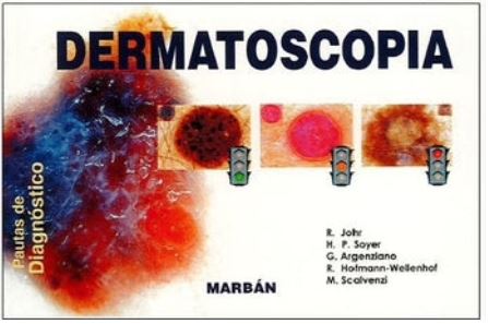 Dermatoscopio DL100 Dermlite