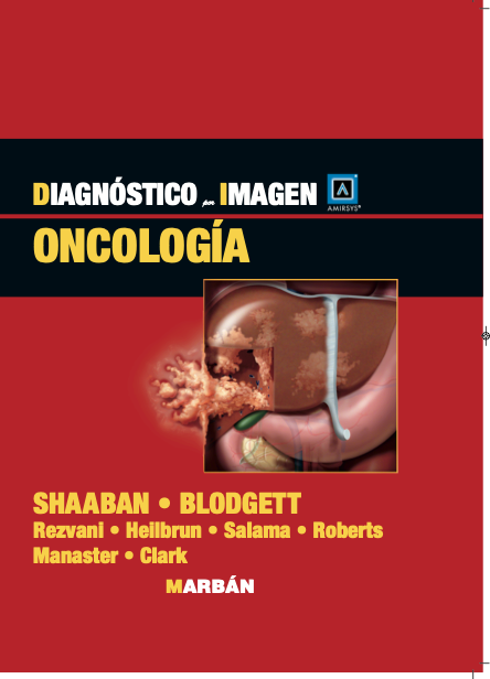 Diagnóstico por Imagen - Oncología - Amirsys