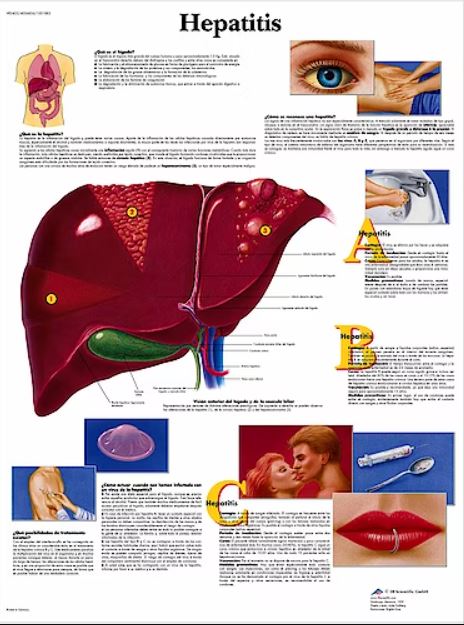 Lámina HEPATITIS