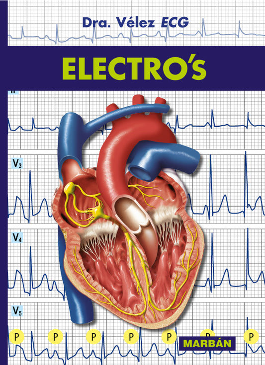 Electro's - Vélez ECG