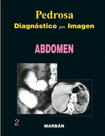 Abdomen ISBN: 9788471015945 Marban Libros