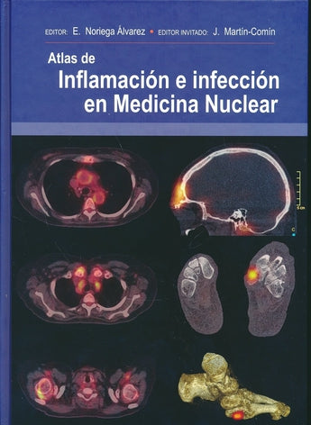 Atlas de Inflamación e Infección en Medicina Nuclear ISBN: 9788478856183 Marban Libros