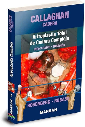 Callaghan Cadera 4. Artroplastia Total de Cadera Compleja. Infecciones. Revisión ISBN: 9788418068454 Marban Libros