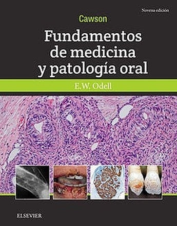 E. Odell - Cawson Fundamentos de Medicina y Patología Oral 9ª ed. ISBN: Marban Libros