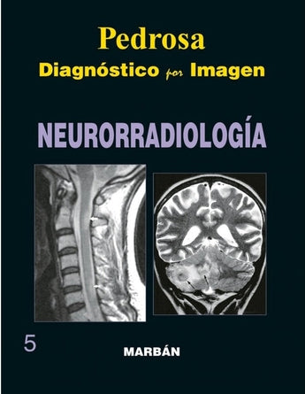 Neurorradiología ISBN: 9788471015976 Marban Libros