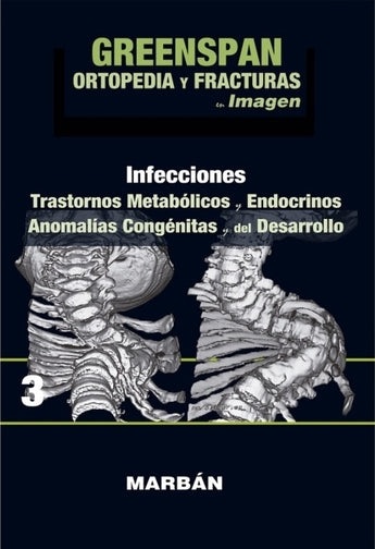 Ortopedia y Fracturas Vol 3 ISBN: 9788416042197 Marban Libros