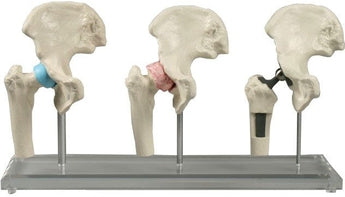 SKU: 1115 - MODELO PRÓTESIS CADERA ISBN: SKU: 1115 Marban Libros