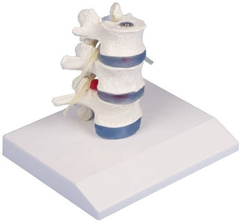 SKU: 4047 - MODELO VERTEBRAS LUMBARES ISBN: SKU: 4047 Marban Libros