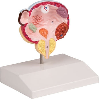 SKU: K243 - MODELO VEJIGA Y PRÓSTATA PATOLÓGICAS ISBN: K243 Marban Libros