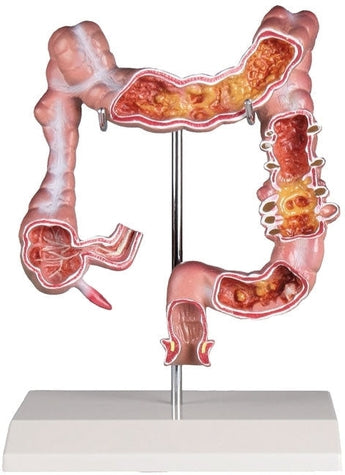 SKU: K285 - MODELO INTESTINO GRUESO PATOLÓGICO ISBN: K285 Marban Libros