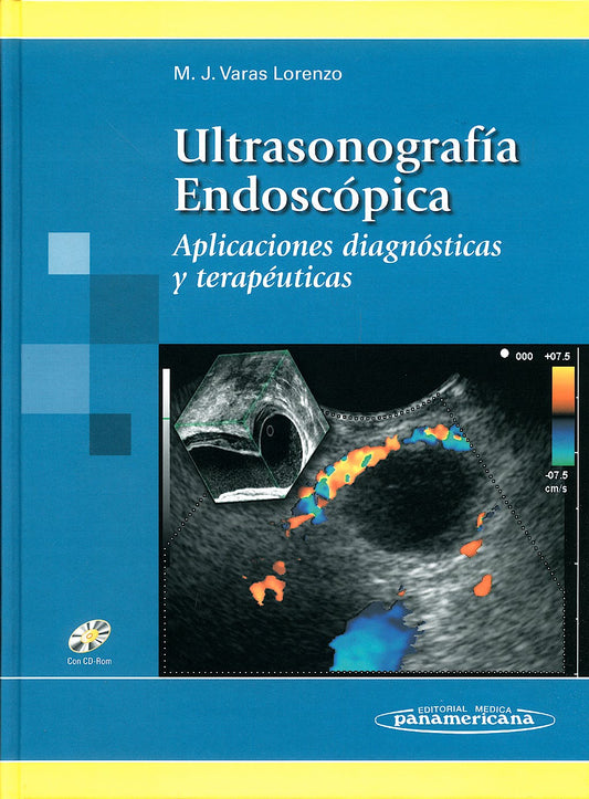 Ultrasonografía Endoscópica Aplicaciones diagnósticas y terapéuticas