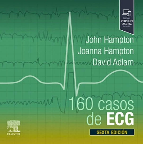 160 Casos de ECG