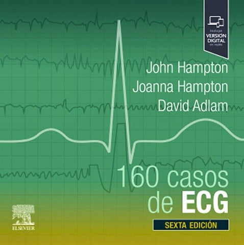 160 Casos de ECG