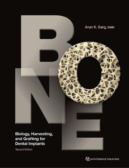 Bone. Biology, Harvesting, and Grafting for Dental Implants