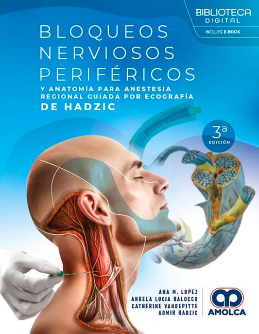 Bloqueos Nerviosos Periféricos