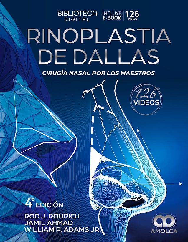 Rinoplastia de DALLAS. Cirugía Nasal por los Maestros
