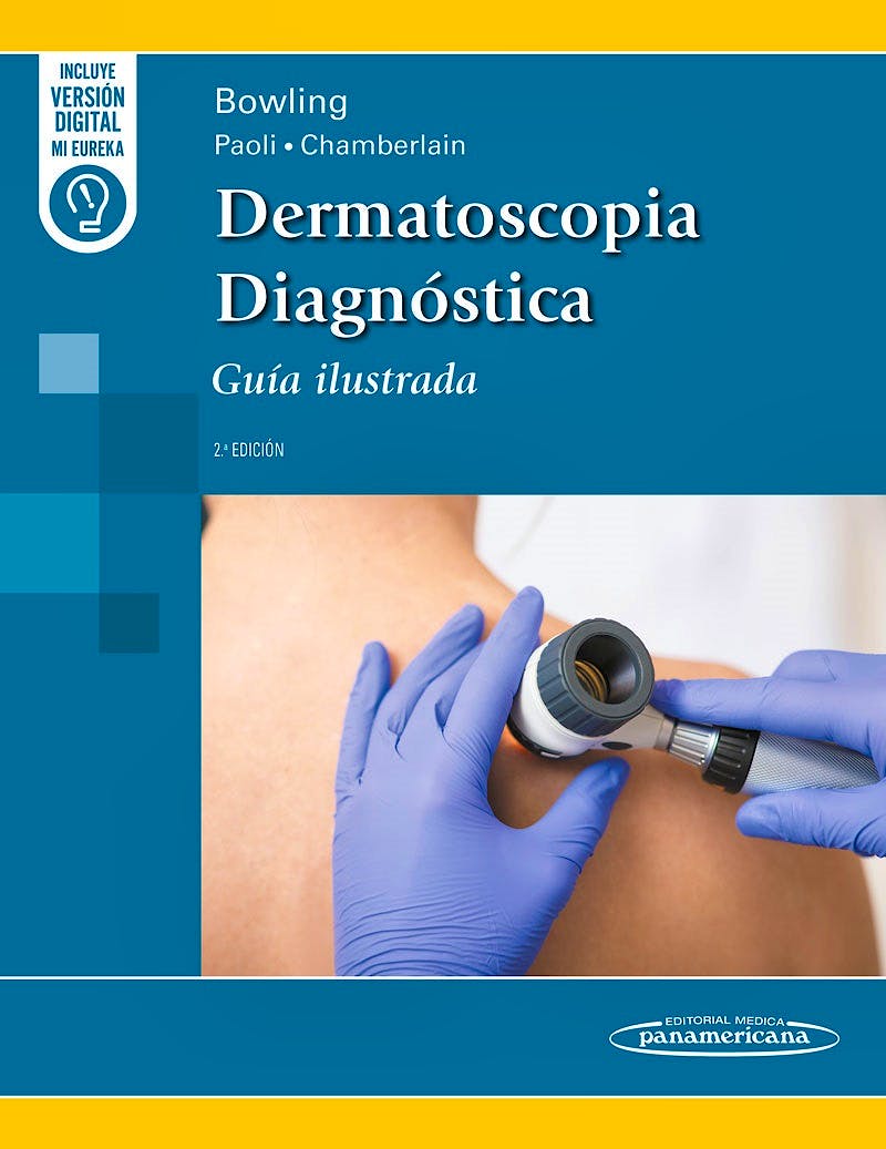 Dermatoscopia Diagnóstica. Guía Ilustrada