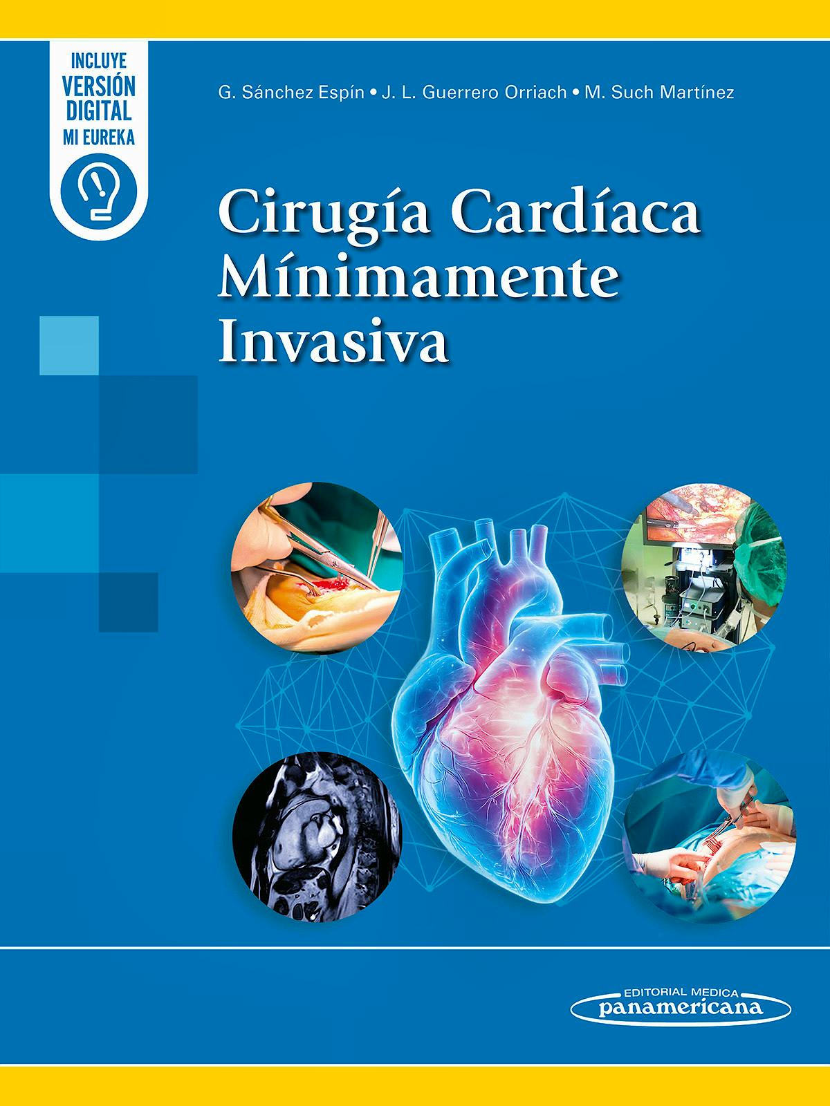 Cirugía Cardíaca Mínimamente Invasiva