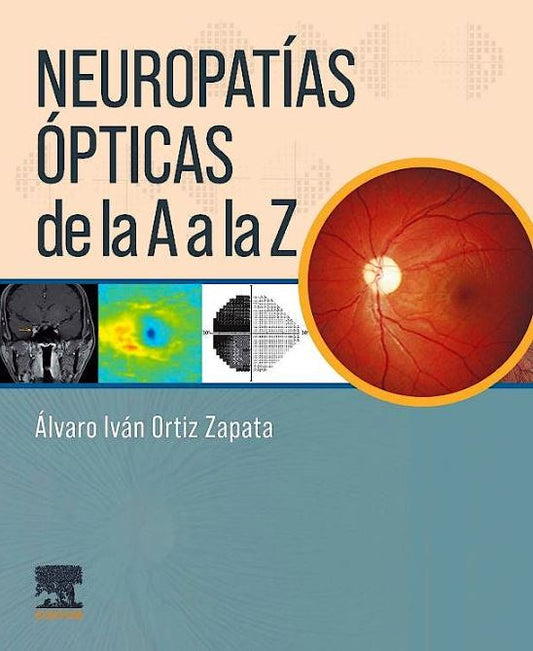 Neuropatías Ópticas de la A a la Z