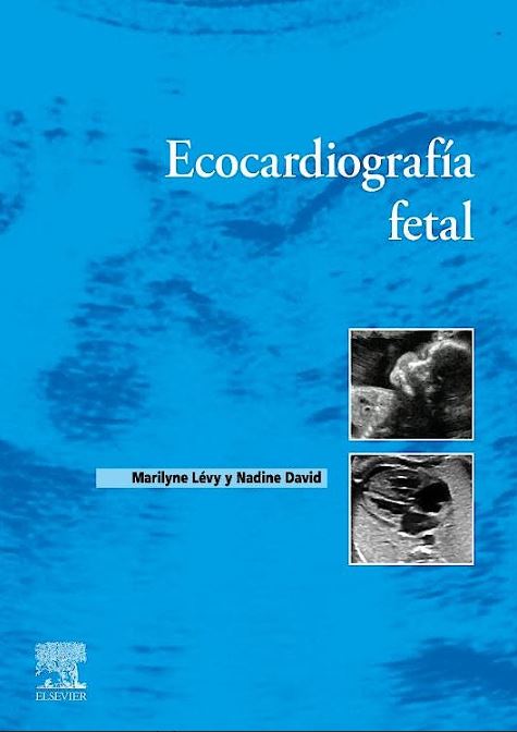 Ecocardiografía Fetal