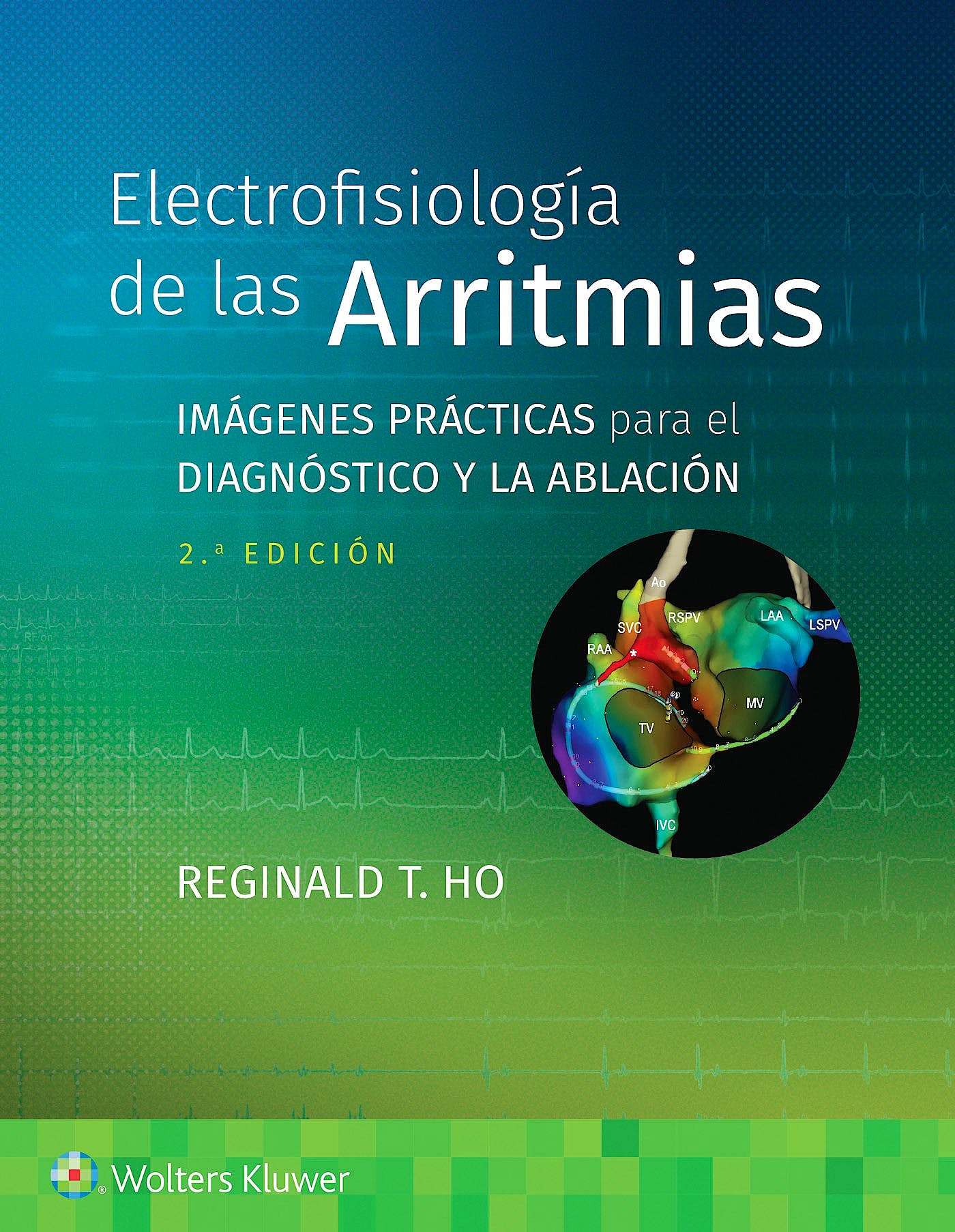 Electrofisiología de las Arritmias. Imágenes Prácticas para el Diagnóstico y la Ablación