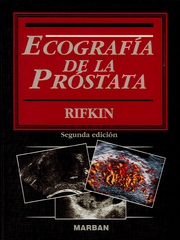 Ecografía de la próstata