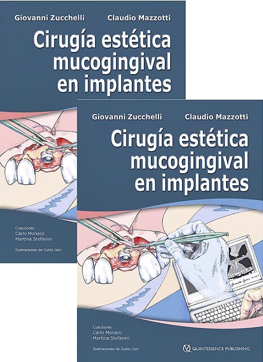 Cirugía Estética Mucogingival en Implantes