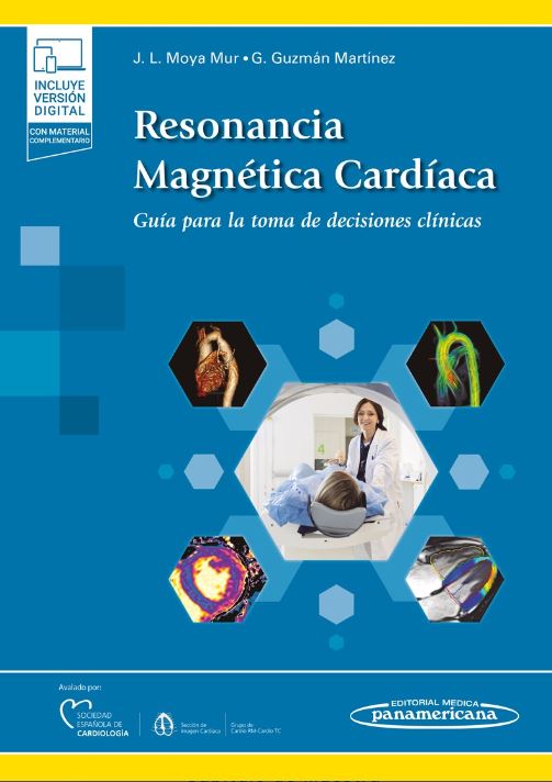Resonancia Magnética Cardíaca. Guía para la Toma de Decisiones Clínicas