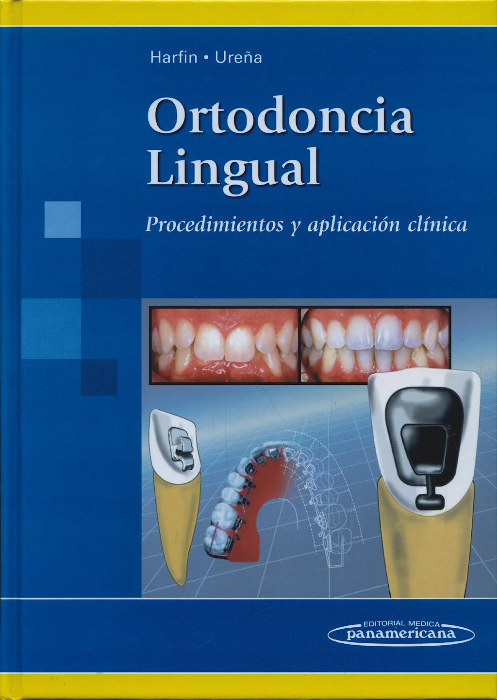 Ortodoncia Lingual. Procedimientos y Aplicación Clínica