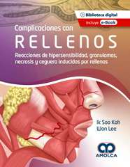 Complicaciones con Rellenos. Reacciones de Hipersensibilidad, Granulomas, Necrosis y Ceguera Inducidos por Rellenos