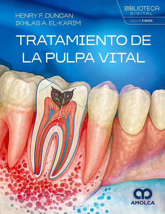 Tratamiento de la Pulpa Vital
