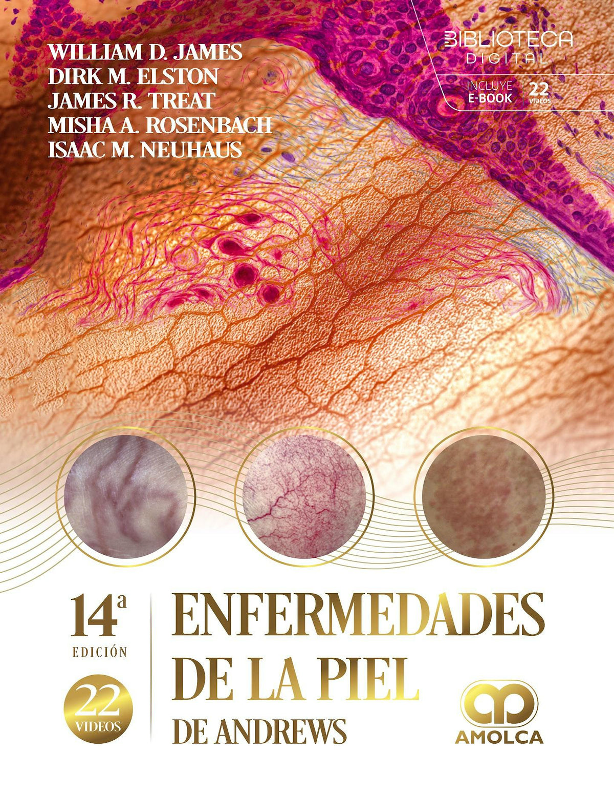 Enfermedades de la Piel de ANDREWS