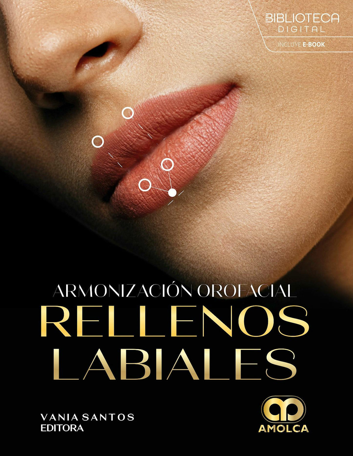 Armonización Orofacial: Rellenos Labiales
