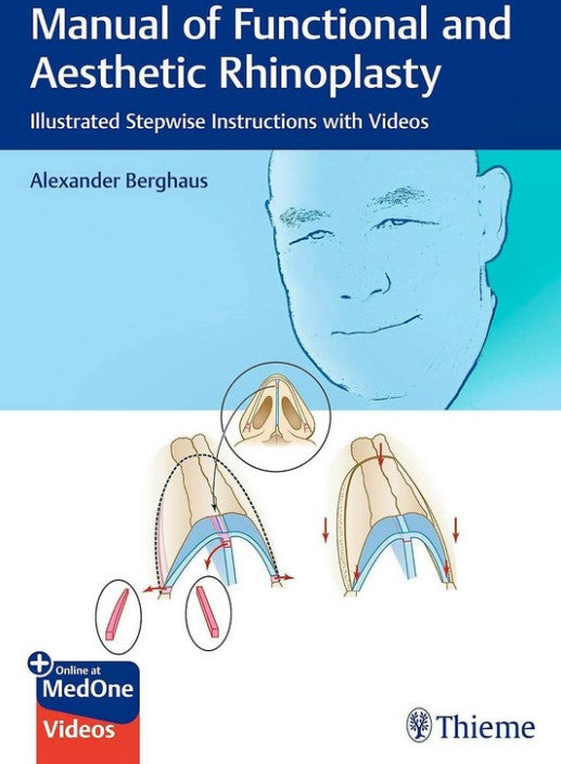 Manual of Functional and Aesthetic Rhinoplasty. Illustrated and Video-based Step-by-Step Instructions