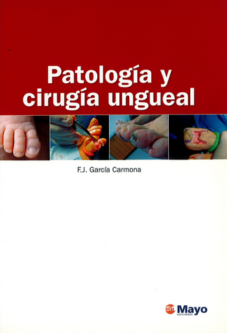 Patología y Cirugía Ungueal