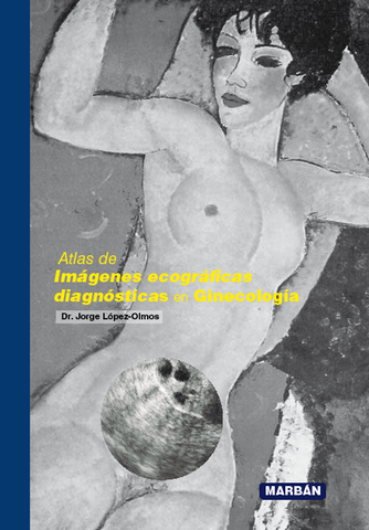 Atlas de imágenes ecográficas diagnósticas en Ginecología - HB
