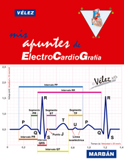Mis Apuntes de ECG - Vélez