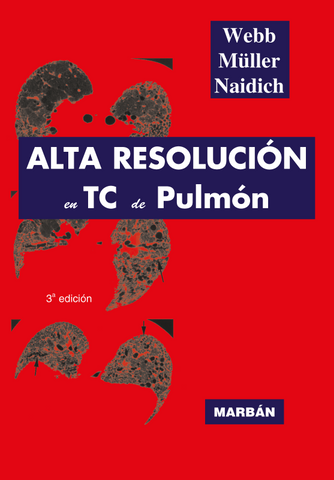 Alta Resolución en TC de Pulmón - Pro