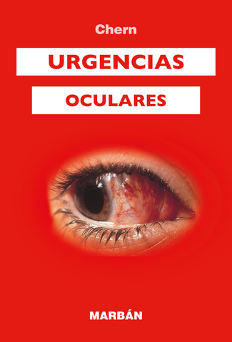 Urgencias Oculares