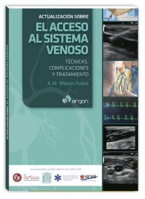 Actualización sobre el Acceso al Sistema Venoso. Técnicas, Complicaciones y Tratamiento