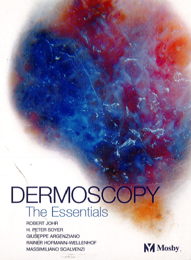Dermoscopy . The Essentials